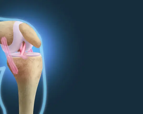 Ilustracja anatomiczna stawu kolanowego z widocznymi więzadłami i kośćmi.