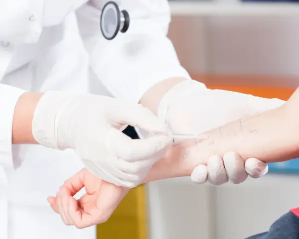 Lekarz w białej rękawiczce wykonuje test skórny na ramieniu pacjenta.