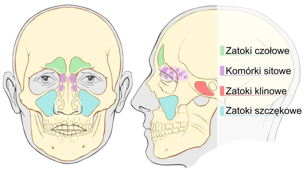 Ilustracja czaszki z zaznaczonymi zatokami: czołowymi, sitowymi, klinowymi i szczękowymi.