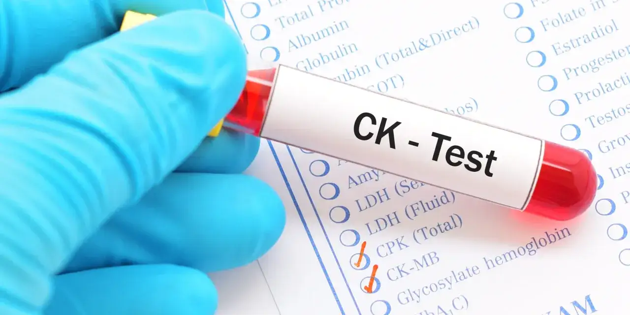 Ręka w niebieskiej rękawiczce trzyma probówkę z krwią do testu CK (kinaza kreatynowa) na tle formularza badań.