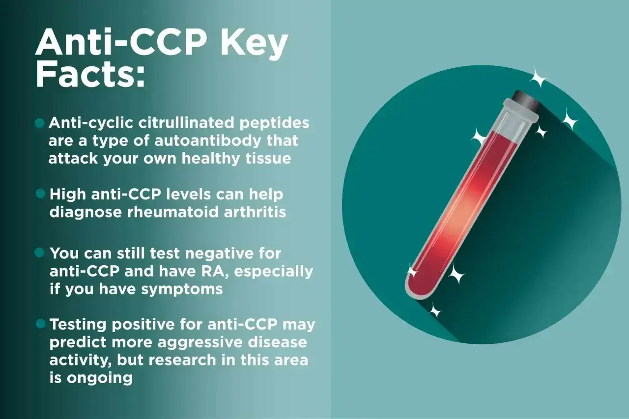 Kluczowe fakty o anty-CCP: przeciwciała atakujące zdrowe tkanki, wysoki poziom anty-CCP pomaga diagnozować RZS.