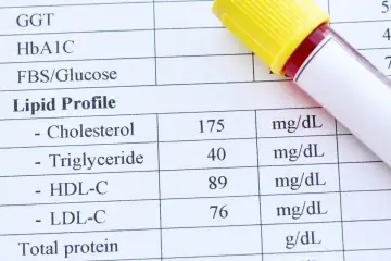 Wynik lipidogramu: cholesterol całkowity 175, triglicerydy 40, HDL-C 89, LDL-C 76. Wynik ten pomaga ocenić ryzyko chorób serca, analizując cholesterol nie-HDL.
