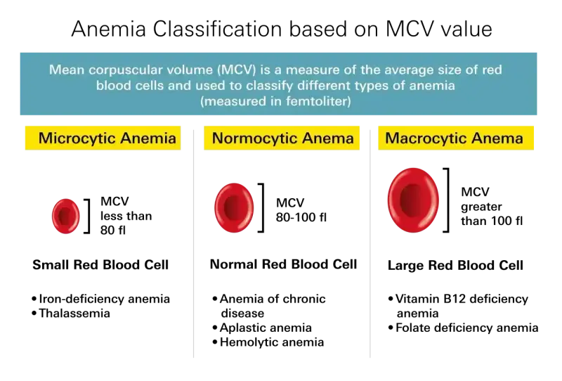 Porównanie wielkości krwinek czerwonych w anemii: mikrocytarna (małe), normocytarna (normalne) i makrocytarna (duże). MCV pomaga w diagnozie.