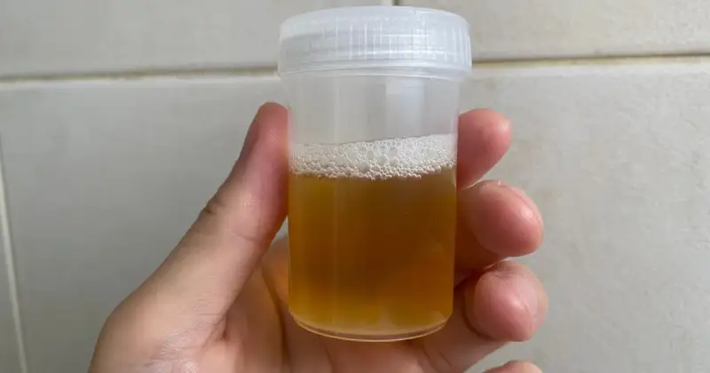 Dłoń trzymająca plastikowy pojemnik z żółtym płynem i pianą na wierzchu.